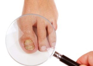 How to recognize the disease